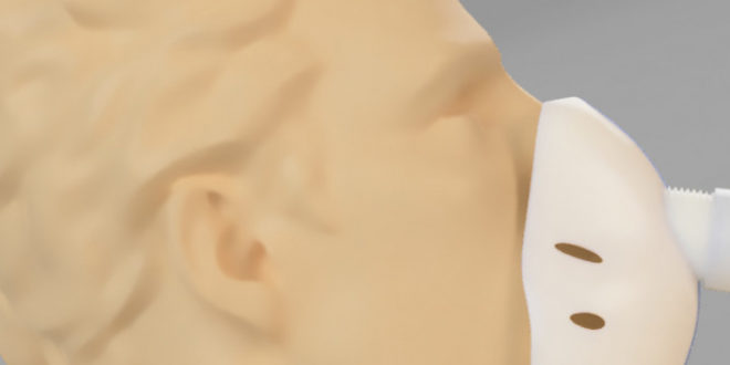 Una delle mascherine realizzate con la stampante 3D