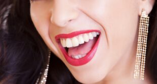 microbioma orale denti